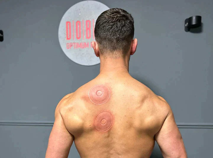 Smart Electric Cupping Massager
